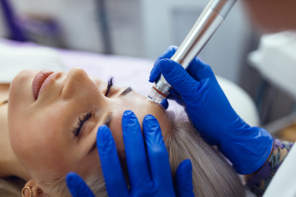 Kobieta podczas zabiegu mezoterapii mikroigłowej; kosmetolog wykonuje delikatne nakłucia na skórze twarzy.