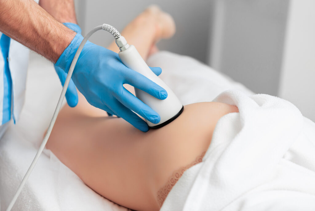 „Liposukcja ultradźwiękowa wykonywana na brzuchu przy użyciu specjalistycznego urządzenia”