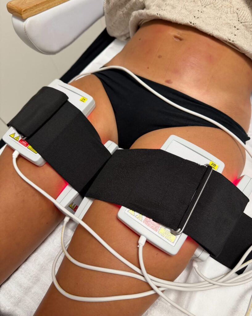 Lipolaser Toruń – nowoczesne modelowanie sylwetki